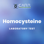 Load image into Gallery viewer, Homocysteine
