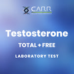 Load image into Gallery viewer, Testosterone - Total &amp; Free
