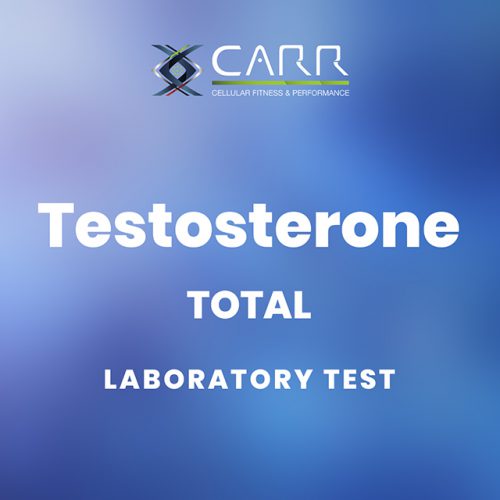 Testosterone - Total